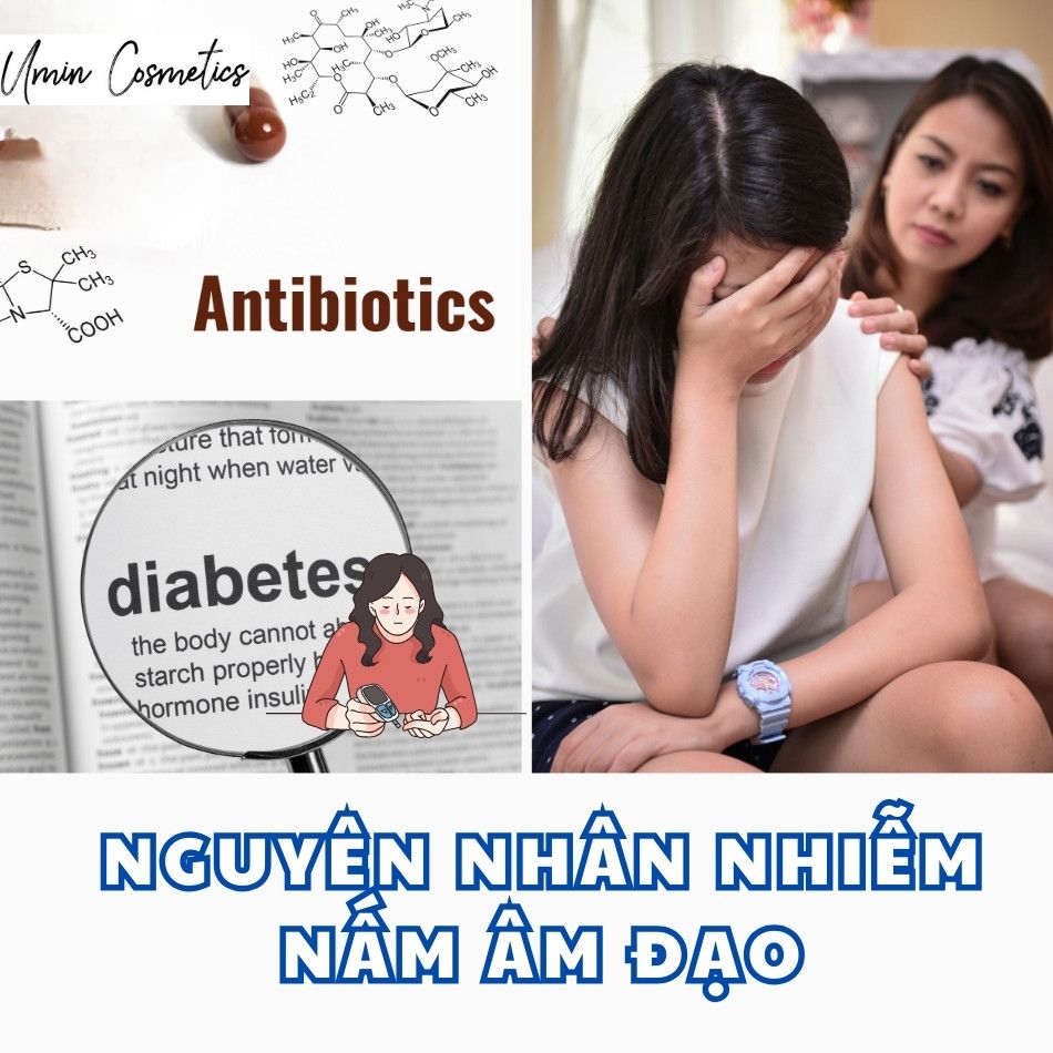 Nguyên nhân nhiễm nấm âm đạo