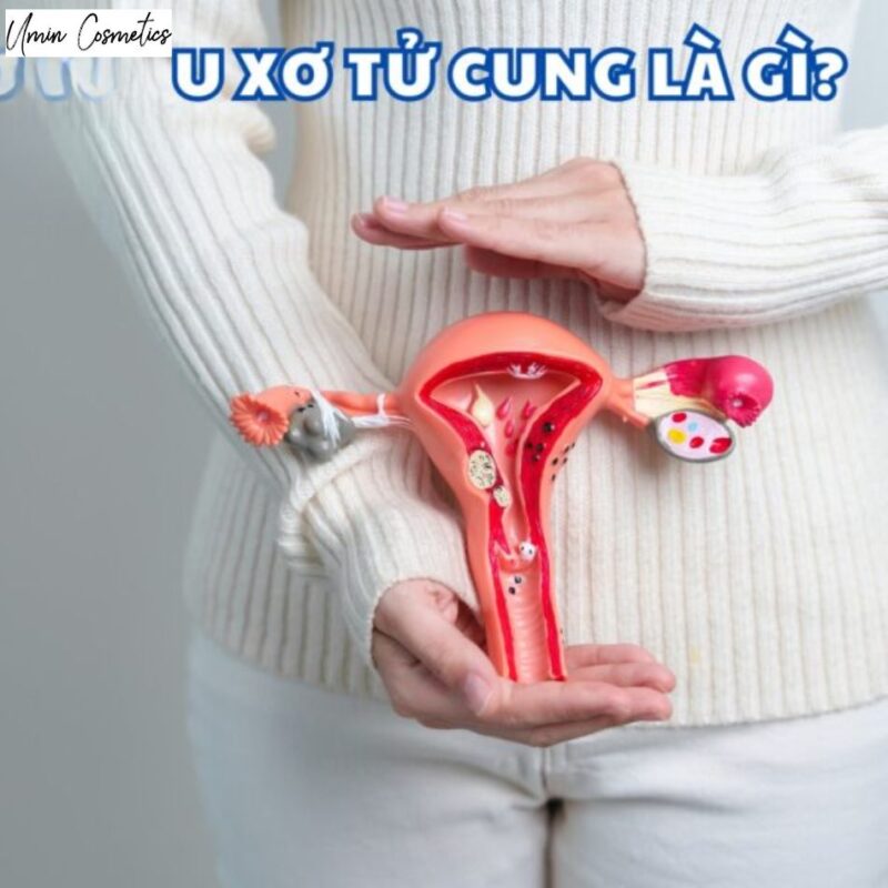 U xơ tử cung